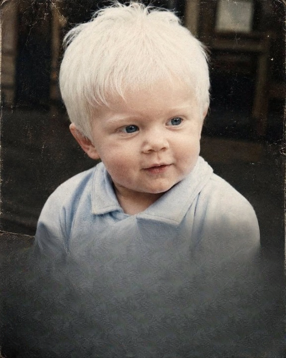 The Boy With Snow White Hair Who Captivated the World Where Is He Now???